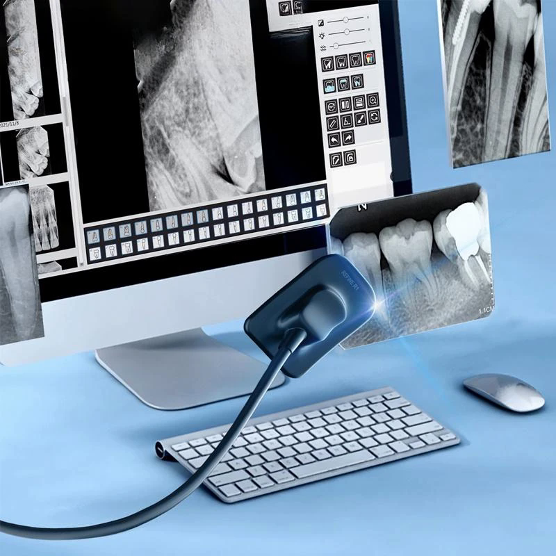 Radiovisiógrafo dental para arrendamiento médico